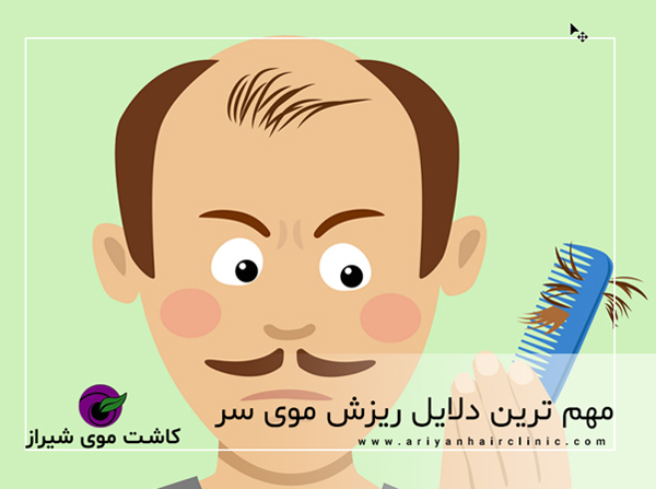 مهم ترین دلایل ریزش موی سر