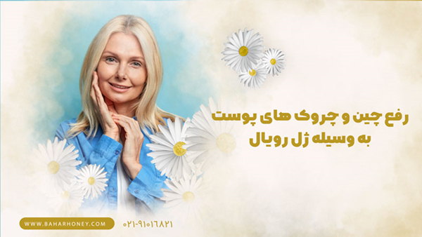 چگونه پوستی شاداب و زیبا با ژل رویال داشته باشیم؟