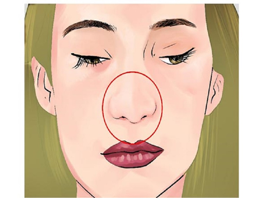 مراحل عمل بینی گوشتی