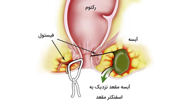 [تصویر:  cliniczarei-2_aUBoJ.jpg]