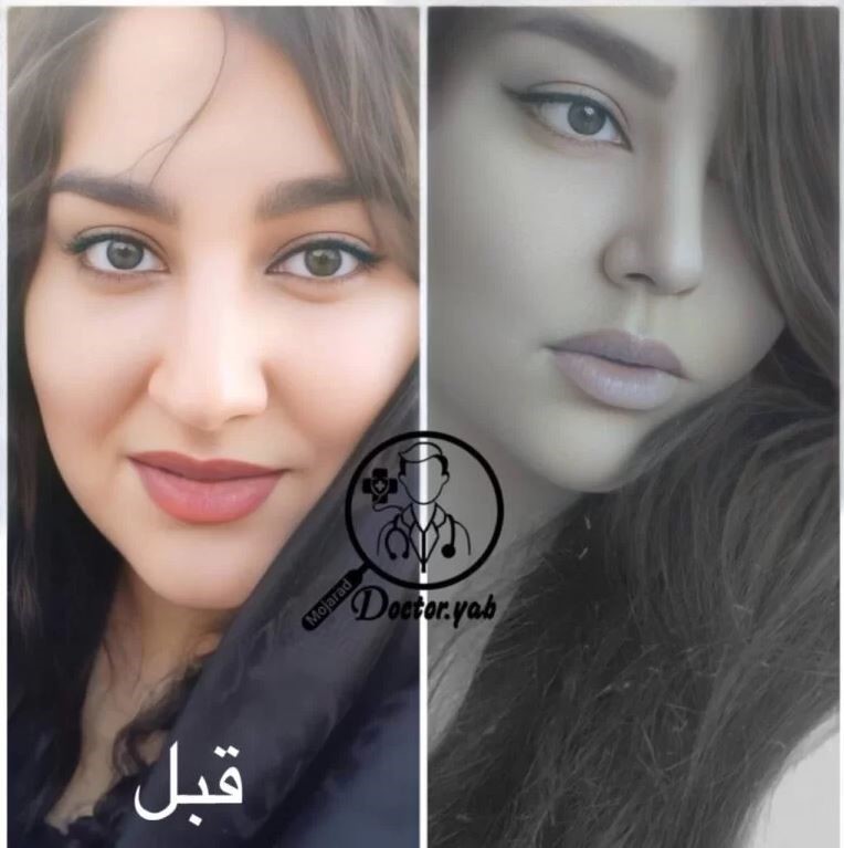 بهترین جراح بینی در شیراز