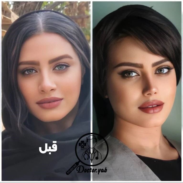 دکی یاب یکی از برترین مراکز جراحی زیبایی در شیراز