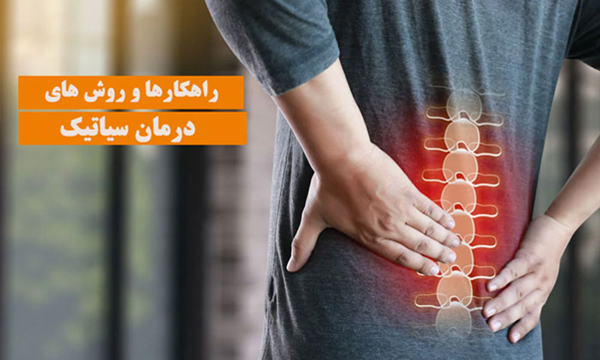 راهکارها و روش های درمان سیاتیک