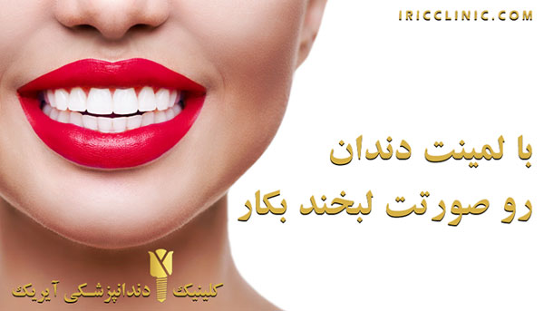 دندانپزشکی آیریک مرکز ایمپلنت غرب تهران
