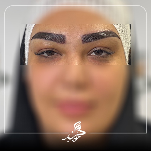 کلینیک زیبایی خورشید قیطریه تهران