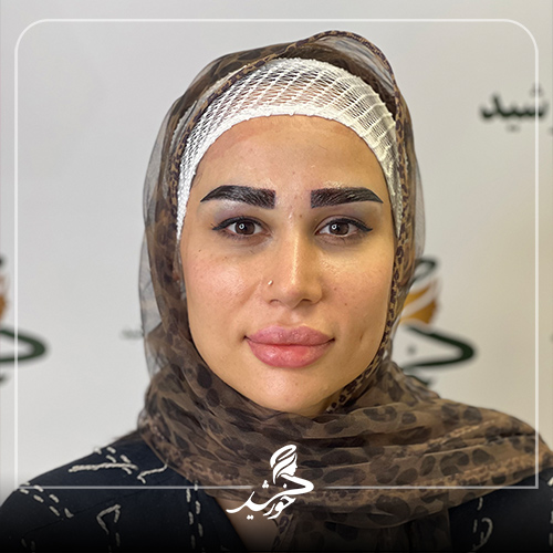 کلینیک زیبایی خورشید قیطریه تهران