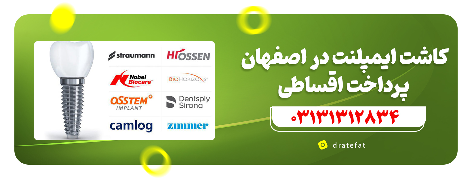 کاشت ایمپلنت در اصفهان، پرداخت اقساطی