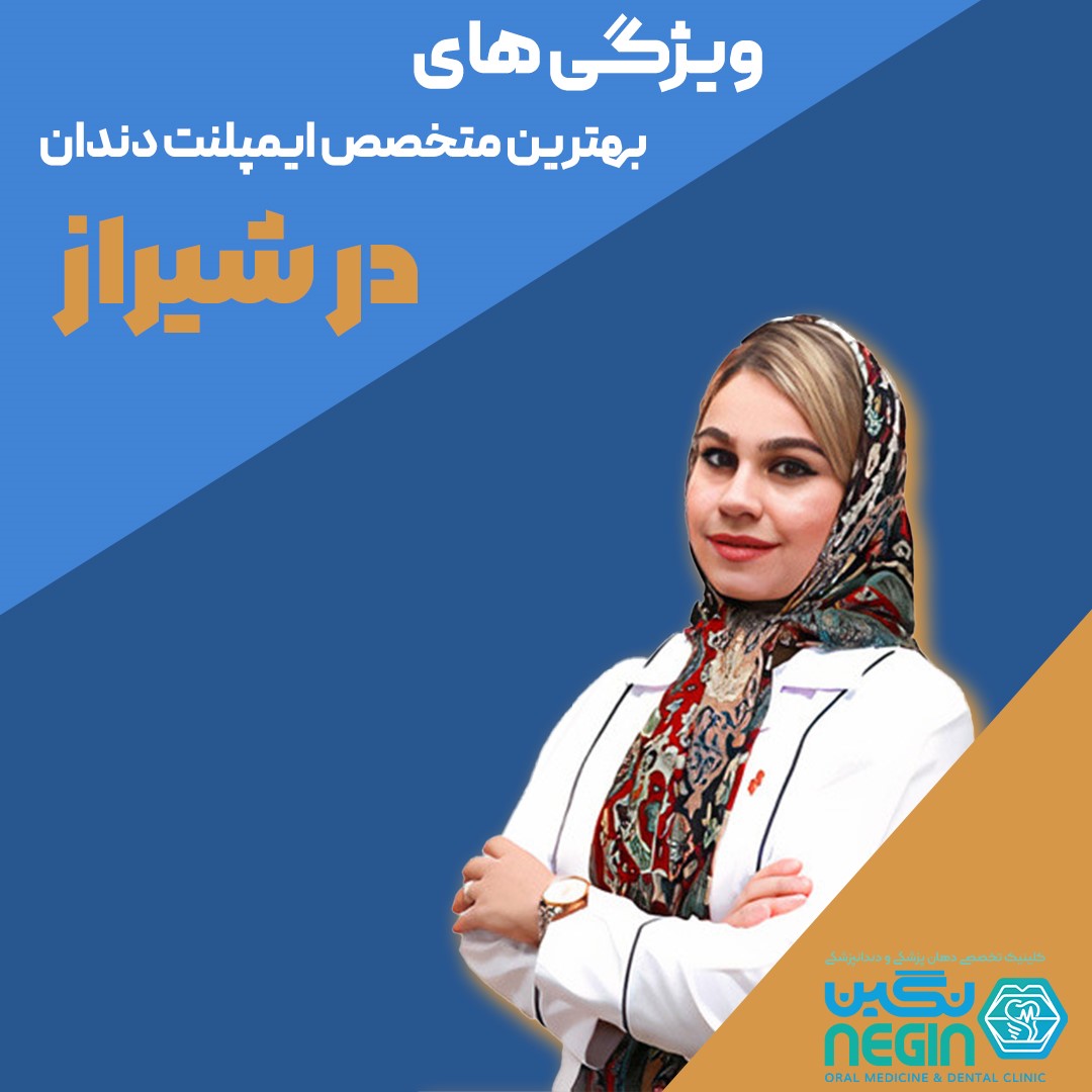 ویژگی های بهترین متخصص ایمپلنت دندان در شیراز