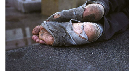 Homelessness