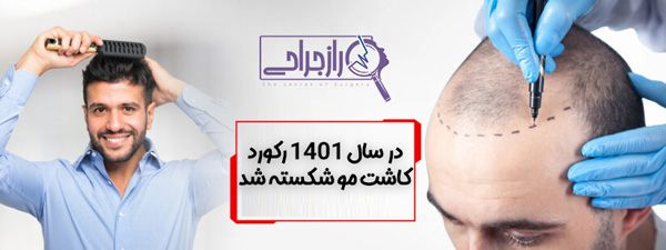 در سال 1401 رکورد کاشت مو شکسته شد