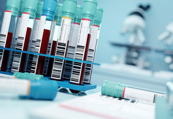تشخیص سرطان: آزمایشات خون و رادیولوژی